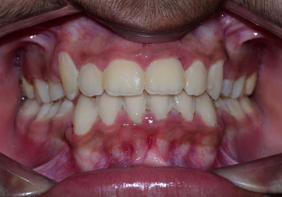 Children's Orthodontics - after