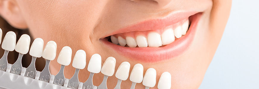 Teeth Whitening