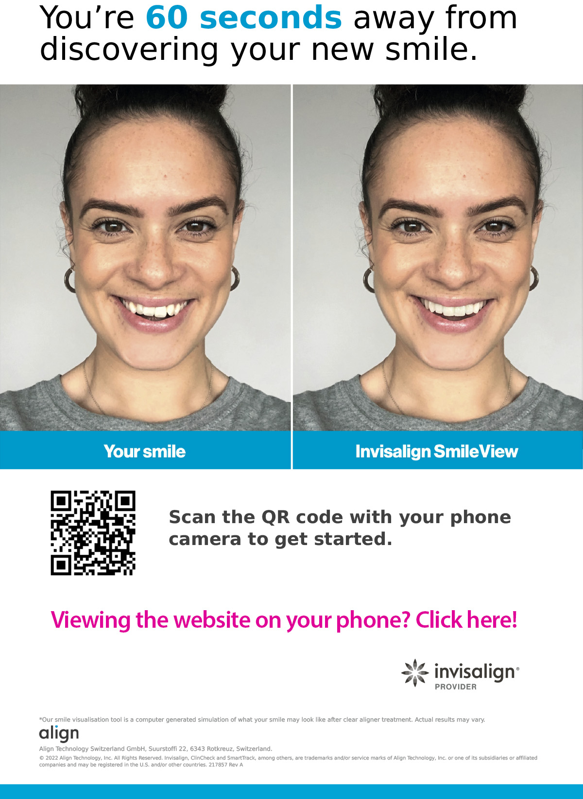 Invisalign Teeth Straightening Preview